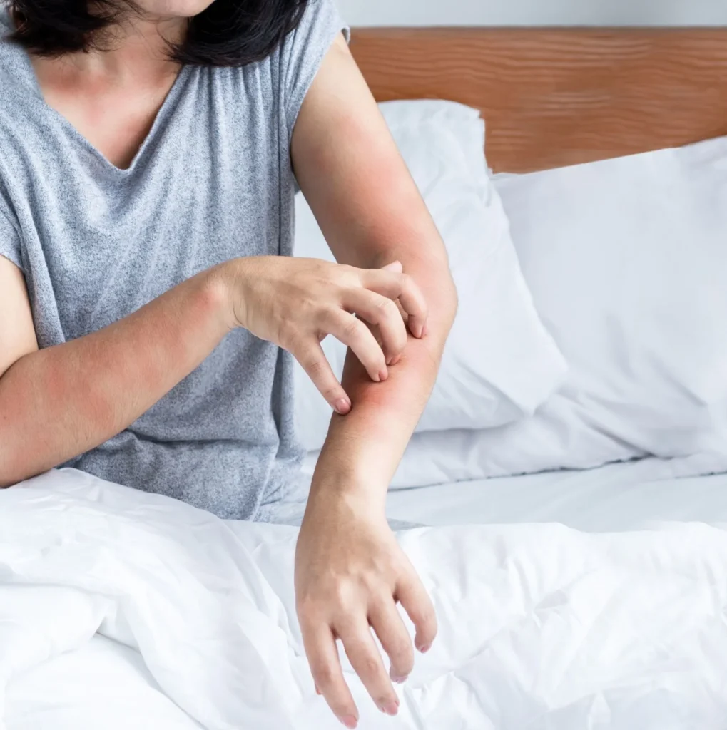 Why Bed Bug Heat Treatments Work Best